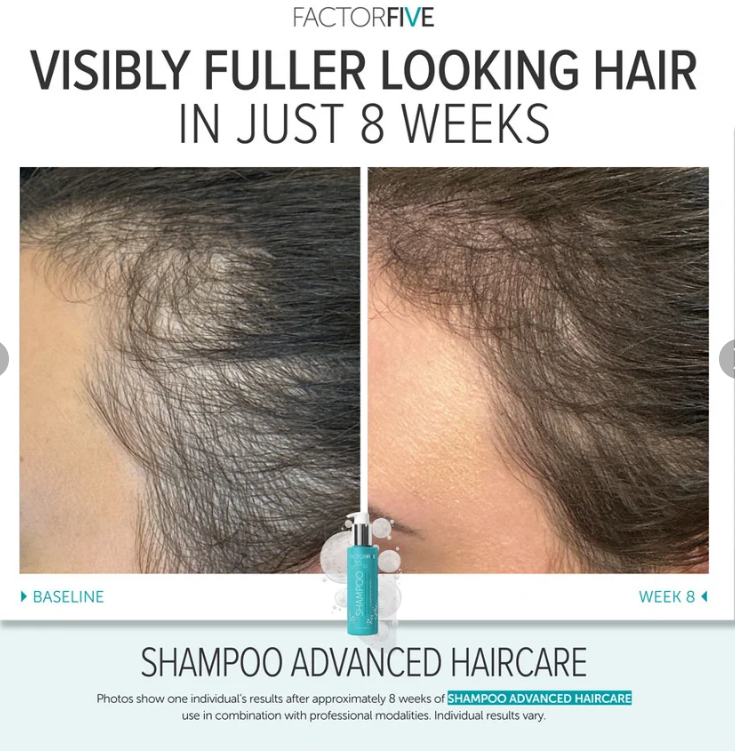 FACTORFIVE Advanced Haircare Shampoo