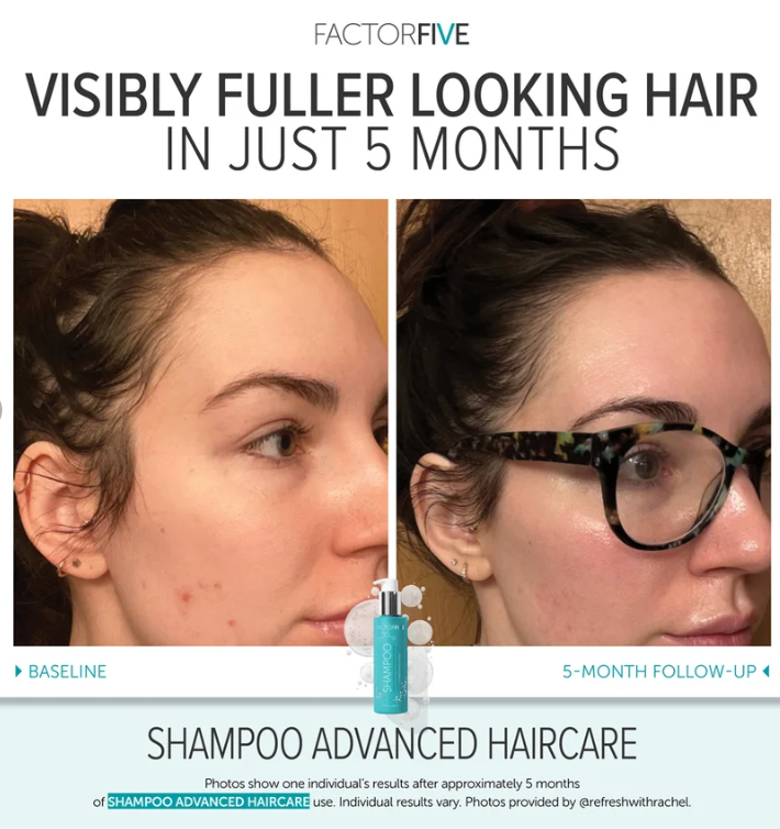 FACTORFIVE Advanced Haircare Shampoo