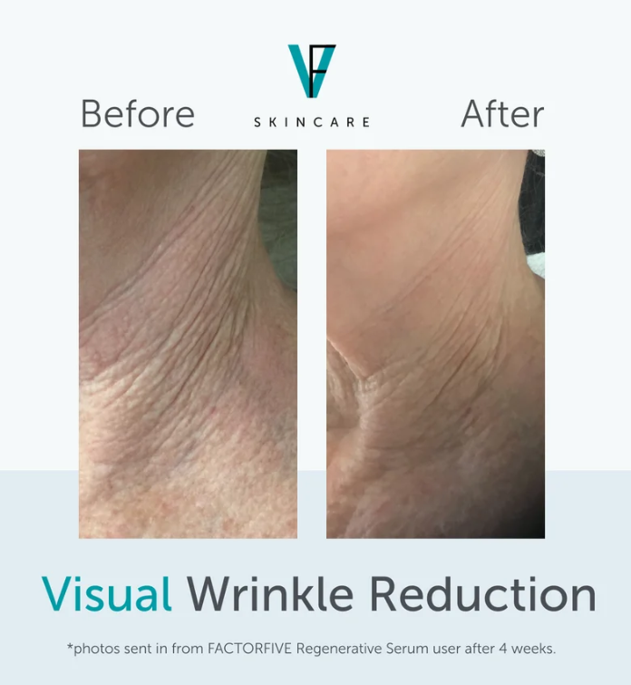 Regenerative Serum